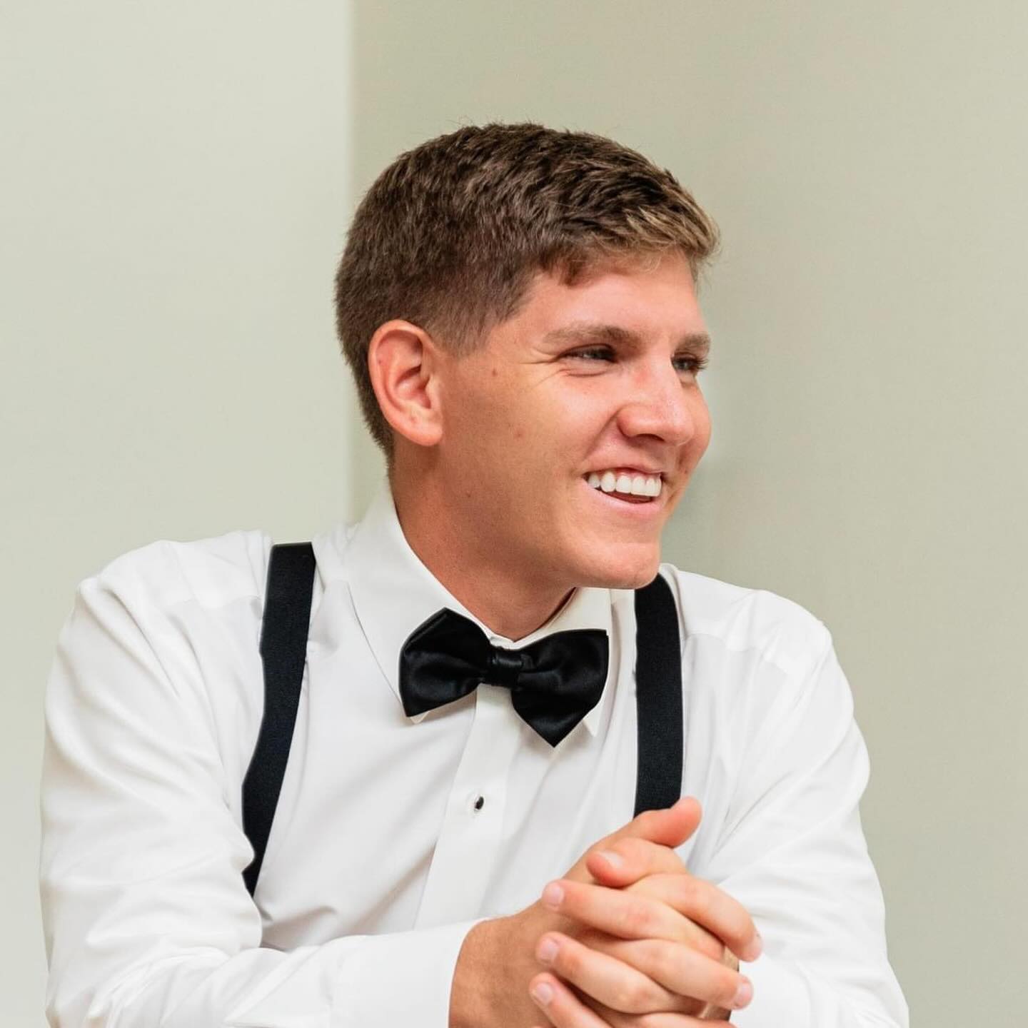 Feature Friday ✨
The most popular smile transformation “wants” requested by my patients are:
▫️I want a whiter smile
▫️I want a fuller smile
▫️I want a wider smile
▫️I want to show less gums
▫️I want more symmetry
▫️I want straighter teeth
▫️I want to get rid of my gaps
▫️I want this/these teeth not to stick out
▫️I want these spots on my teeth gone
Also, one of the most common occasion when my patients want their smile transformed is for their big day, their upcoming wedding day! Had the great privilege to work with this patient who wanted his smile transformed for his wedding day. He had his front teeth bonded (composite) for years and just hated his smile his entire life. He was always self-conscious about his smile so it made him to not want to smile in any of his past photos.
I strengthened and enhanced his smile by:
☑️ created symmetry
☑️ reshaped his front 4 teeth
Procedures:
🔘 gum reshaping by laser
🔘 4 lithium disilicates (LD) ceramic crowns & veneers
End result = a happy smiling patient who now confidently smiles BIG in all of his photos (case and point, look how amazing he looks in his forever wedding photo) 🤩
If you’re wanting any of the above “wants” done correctly, then partner with an experienced, trained, AND artistic cosmetic dentist who can actually walk the talk to achieve them.
To schedule a consultation = link in bio
#fridayfeature #fridayvibes #smilemore #smilemakeover #smiletransformation #morethanmeetstheeye #beautifulsmile #porcelainveneers #cosmeticdentistry #sogood #anotherhappycustomer #pittsburgh #topdentist #whosnext #wowsmile #changinglives #beconfident #treatyourself #mindblown #canineprotection #friyay #weddingday #gettingready #bigday #ido #musthave #biggerisbetter #newyearnewyou