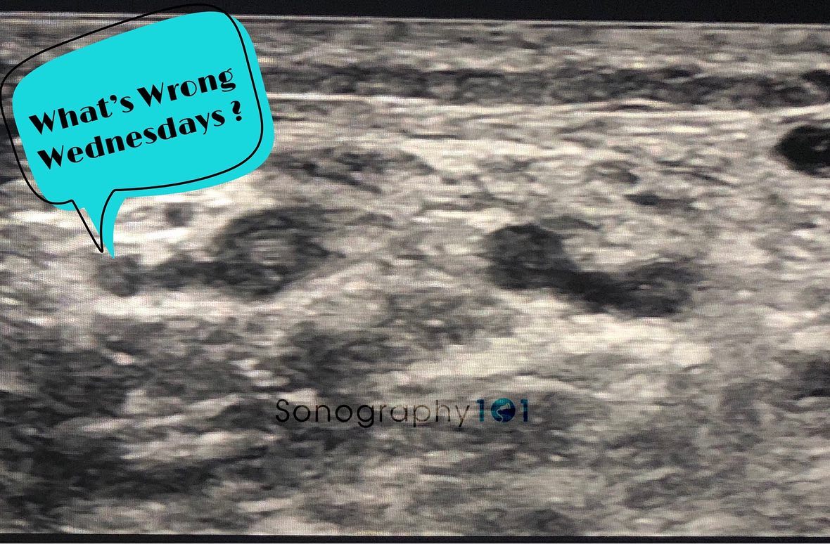 What’s the diagnosis for this week? Can you tell what vessels are these? and what’s wrong with them?