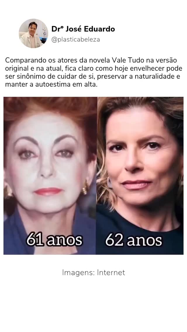 O tempo passa para todos… mas o padrão de envelhecimento mudou, e muito!
Comparando os atores da novela Vale Tudo na versão original e na atual, fica claro como hoje envelhecer pode ser sinônimo de cuidar de si, preservar a naturalidade e manter a autoestima em alta.
A medicina estética e a cirurgia plástica evoluíram para oferecer resultados mais sutis, harmônicos e personalizados. ✨
Envelhecer bem é possível, e começa com escolhas conscientes de cuidado.
#santos #cirurgiaplastica #baixadasantista #estetica #beleza #pelesaudável #pelenova #envelhecimentosaudável #valetudo