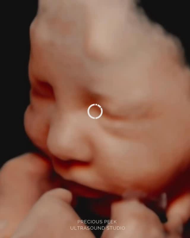 Can’t wait to meet your little bestie? 💕 Come sneak a peek at those adorable cheeks before the big day!
📍treasure coast, fl