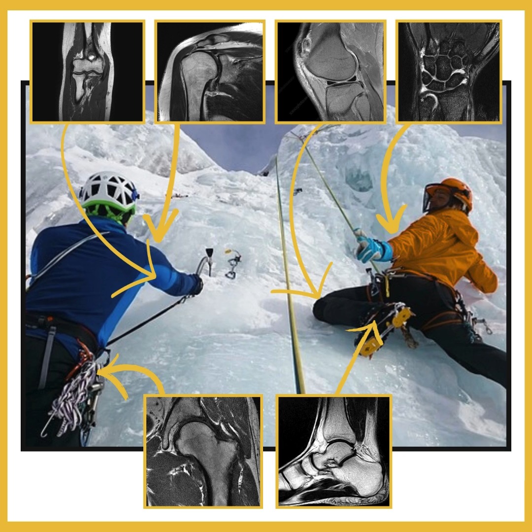 You may not be ice climbing in Norway, but still... there's really not a body part you don't want working at 100%.
Let us help you get back to what you love.
#wepreferouriceinaglass #butwetotallysupportyou #iceclimbing #wintersports #MRI #private #diagnosticimaging #kelowna #okanagan #whatsyourreason