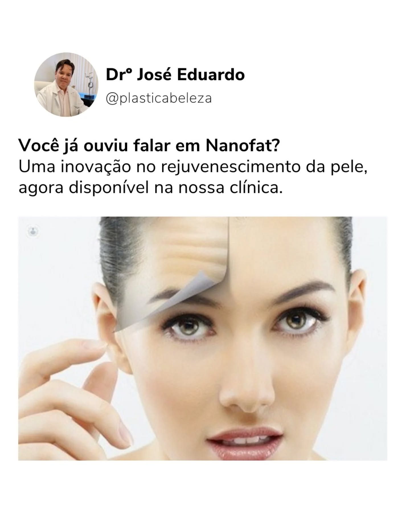 Arrasta para o lado e confira todos os benefícios e curiosidades sobre essa inovação do mundo da estética que promete rejuvenescer a sua pele 😉➡️
Agende a sua avaliação e descubra se o Nanofat é o procedimento ideal para você 📲
#nanofat #rejuvenescimento #rejuvenescimentofacial #estetica #pelesaudável #beleza #cirurgiaplastica