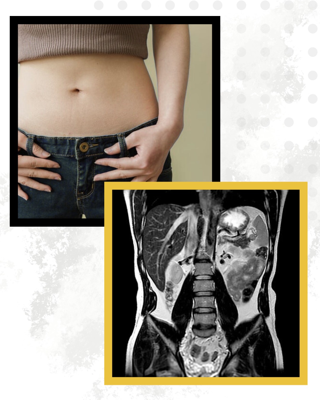 It's what's on the inside that counts.
#GoodAdvice #ListenToYourMama #DontJudgeABookByItsCover #InsideOut #MRI #HealthCare #DiagnosticImaging #Kelowna #Okanagan #WereHereToHelp #WhatsYourReason