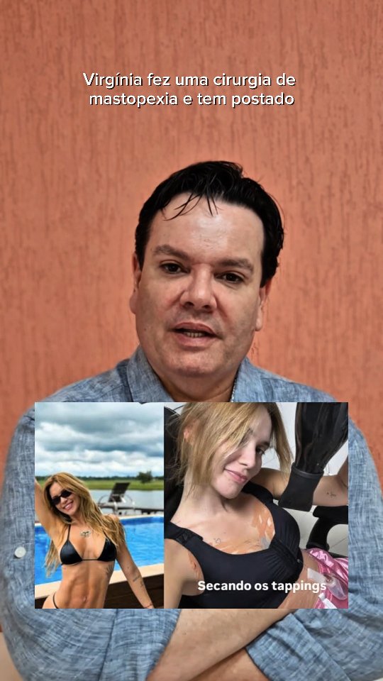 Esse procedimento, também conhecido como lifting de mamas, é indicado para corrigir a flacidez, reposicionar os seios e devolver a autoestima de muitas mulheres.
Especialmente após gestação, perda de peso ou envelhecimento natural.
Recentemente, a influenciadora Virgínia Fonseca passou pela cirurgia e trouxe ainda mais visibilidade para esse tema.
Mais do que levantar os seios, a mastopexia levanta a autoconfiança de quem decide cuidar de si.
Se informar é o primeiro passo. Agir por vocsê mesmo é o segundo!
#cirurgiaplasticaemsantos #cirurgiaplastica #Santos #cirurgiaoplastico #mamoplastia