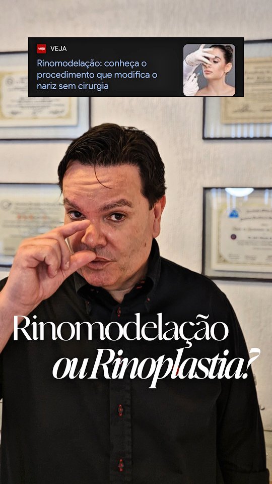 A rinomodelação pode sim oferecer resultados estéticos pontuais, mas nem todo nariz pode (ou deve) ser tratado apenas com preenchedores.
O que tem acontecido?
Muitos profissionais, que nem são cirurgiões plásticos, estão realizando rinomodelações em casos que exigem cirurgia, e isso tem gerado complicações graves e até danos irreversíveis.
Nem sempre a solução rápida e “menos invasiva” é a mais segura.
Por isso, antes de qualquer procedimento, procure um cirurgião plástico de verdade, que vai avaliar o seu caso com responsabilidade.
Sua saúde e seu rosto não são lugar para improviso.
📍Agende sua avaliação com um especialista!
#rinomodelação #rinoplastia #cirurgiaplasticaemsantos #cirurgiaoplastico #beleza #estética #baixadasantista