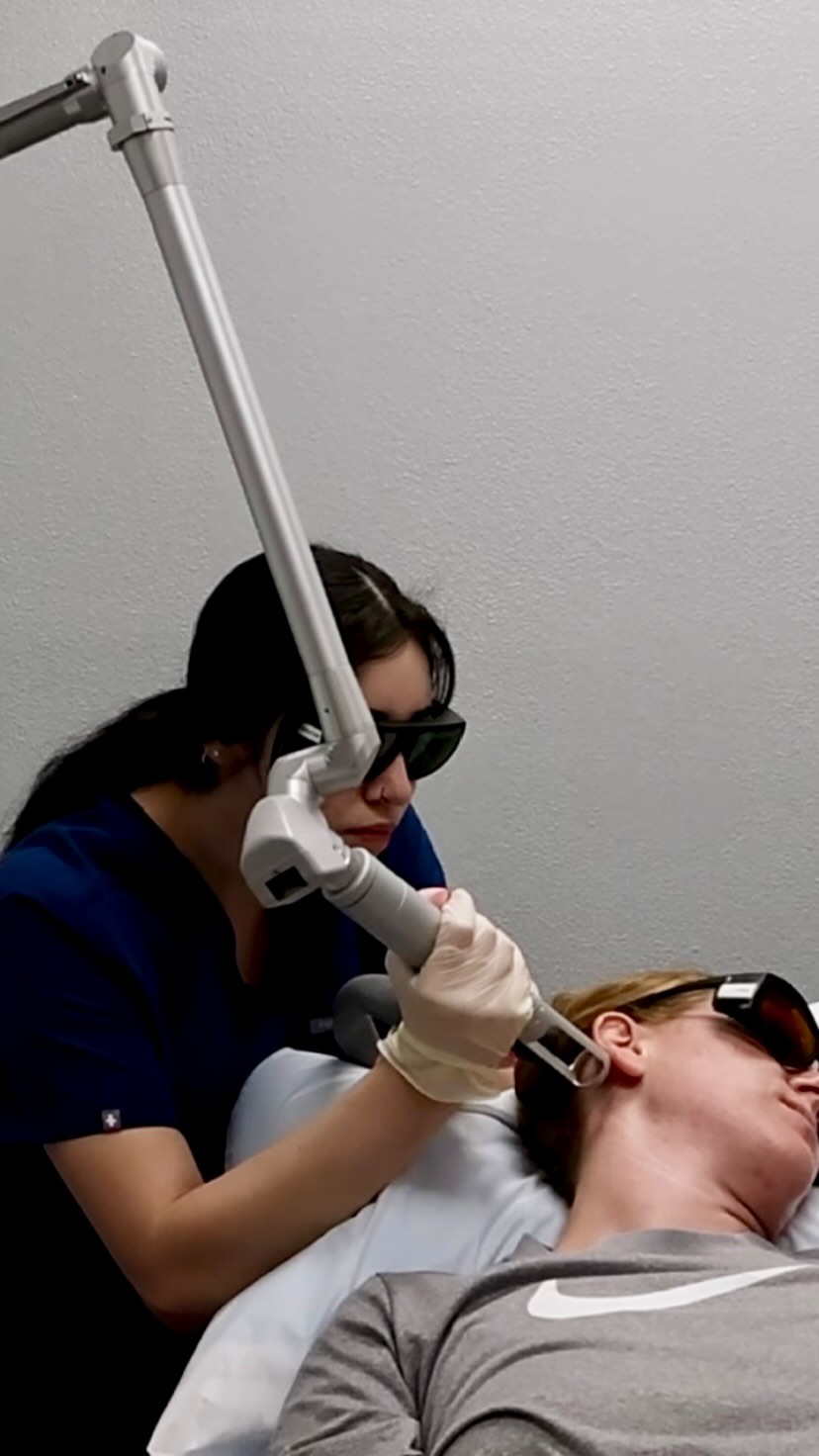 An amazing tattoo removal session with @laserme.cc today!
Thinking about removing a tattoo? Book your session now! 🗓️
📞 Call: 520-618-0232
📍Visit: 2732 N. Alvernon Way Tucson, AZ 85712
🖥️ Visit: www.renew360az.com
#ReNew360 #TucsonArizona #TattooRemoval #PiQo4Laser #InkFree