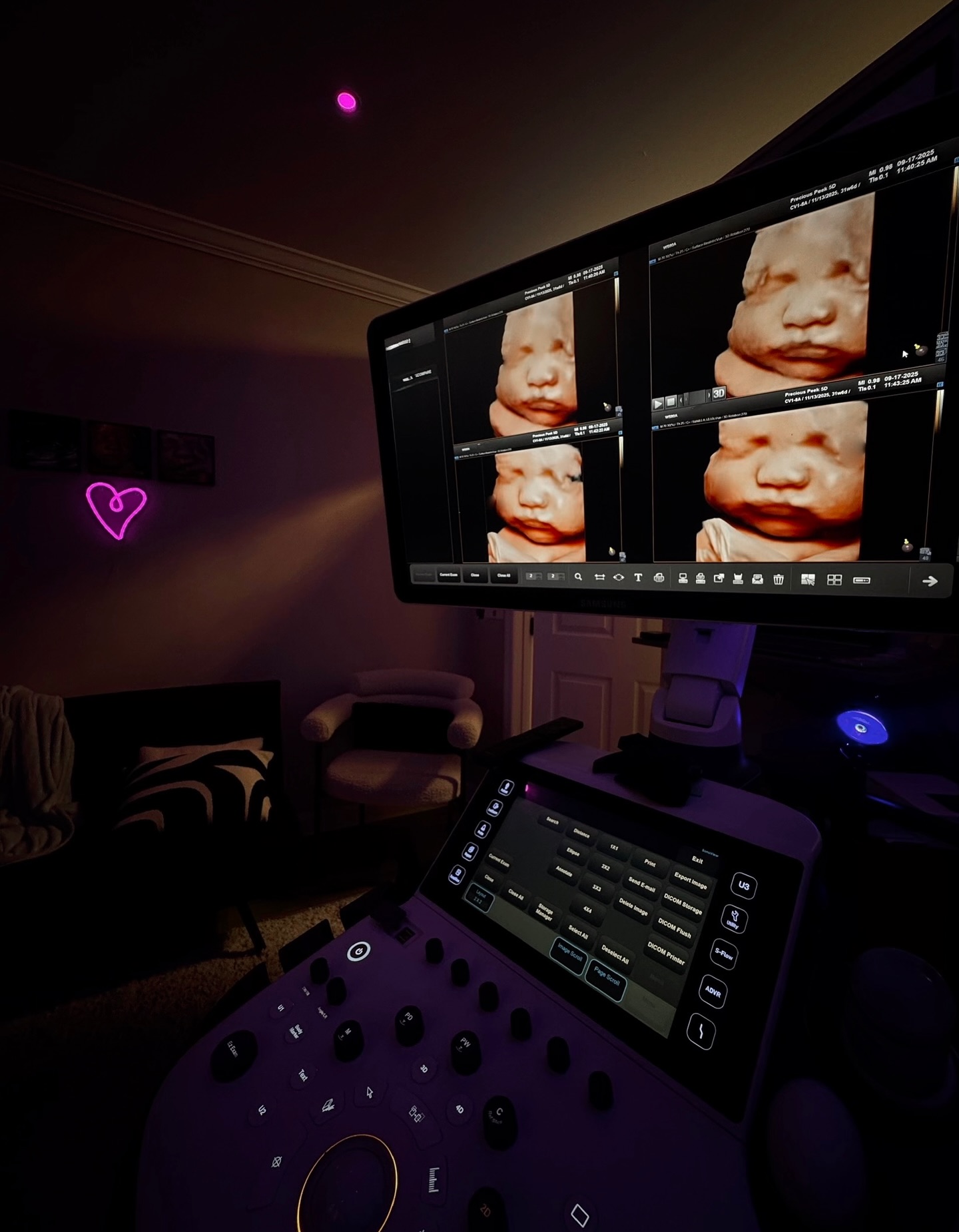 💗 31 weeks + 6 days
#pregnant #pregnancy #pregnancyjourney #3rdtrimester #babygirl #4dultrasound #3dultrasound #5dultrasound