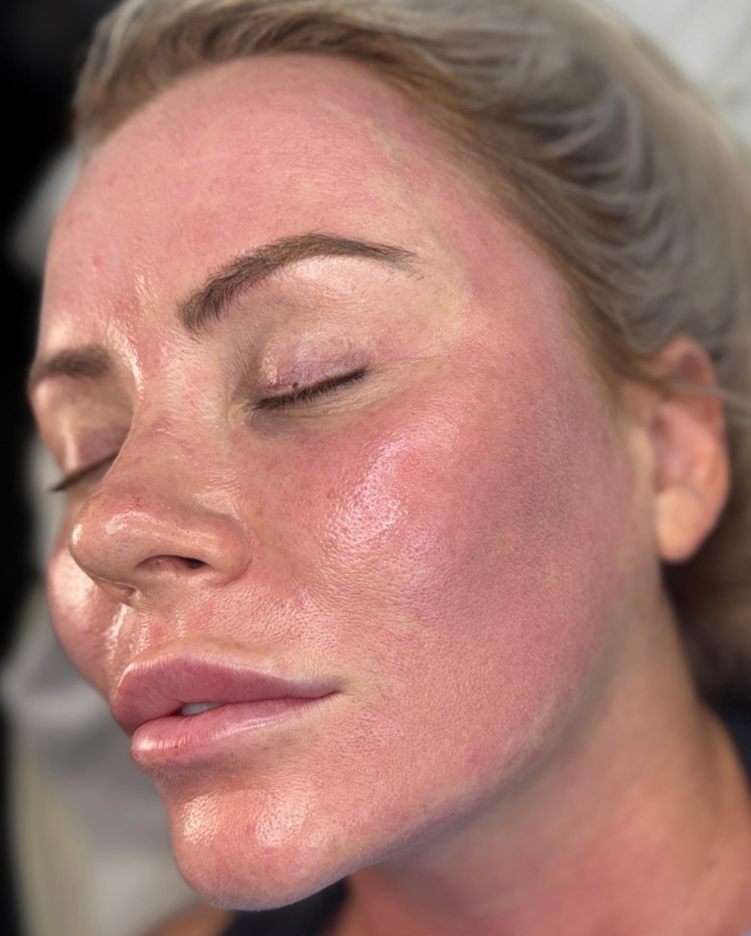 Saying no to anything that isn’t good for my skin, my face, or my peace in 2026!
Everyone deserves glowing skin …. Our HydraFacial delivers outstanding results and is perfect for any skin type.
HydraFacials cleanse, exfoliate, and infuse your skin with the nourishment it needs to look and feel its best!
It gives your skin exactly what it needs in the colder months:
✔️ Hydration
✔️ Clear pores
✔️ A dewy complexion with brighter healthier skin!
January is already looking busy, so if you’re planning treatments, now’s the time to get booked in.
📍 Ultra Aesthetics
📩 DM to book or use the link in bio