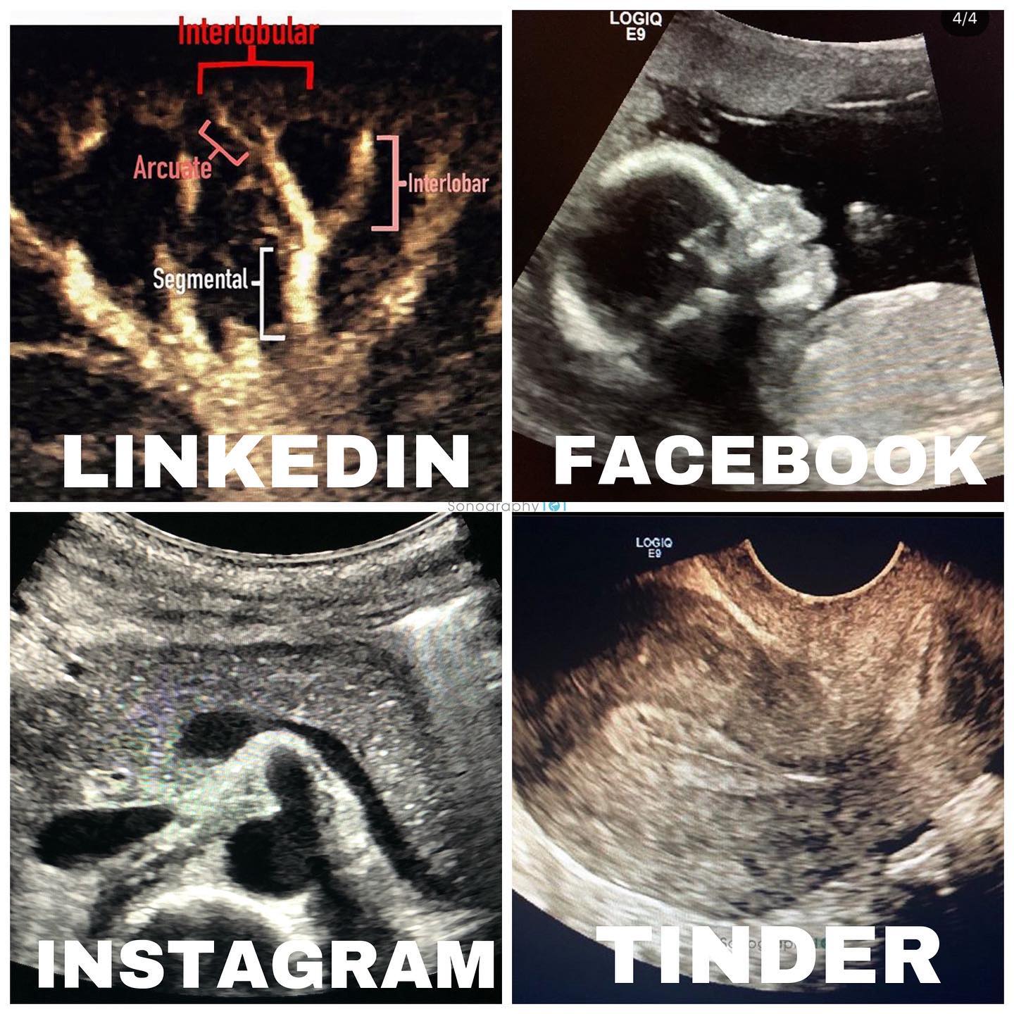 A little late but I just had to 🤣 the Sonography101 version of the #dollypartonchallenge