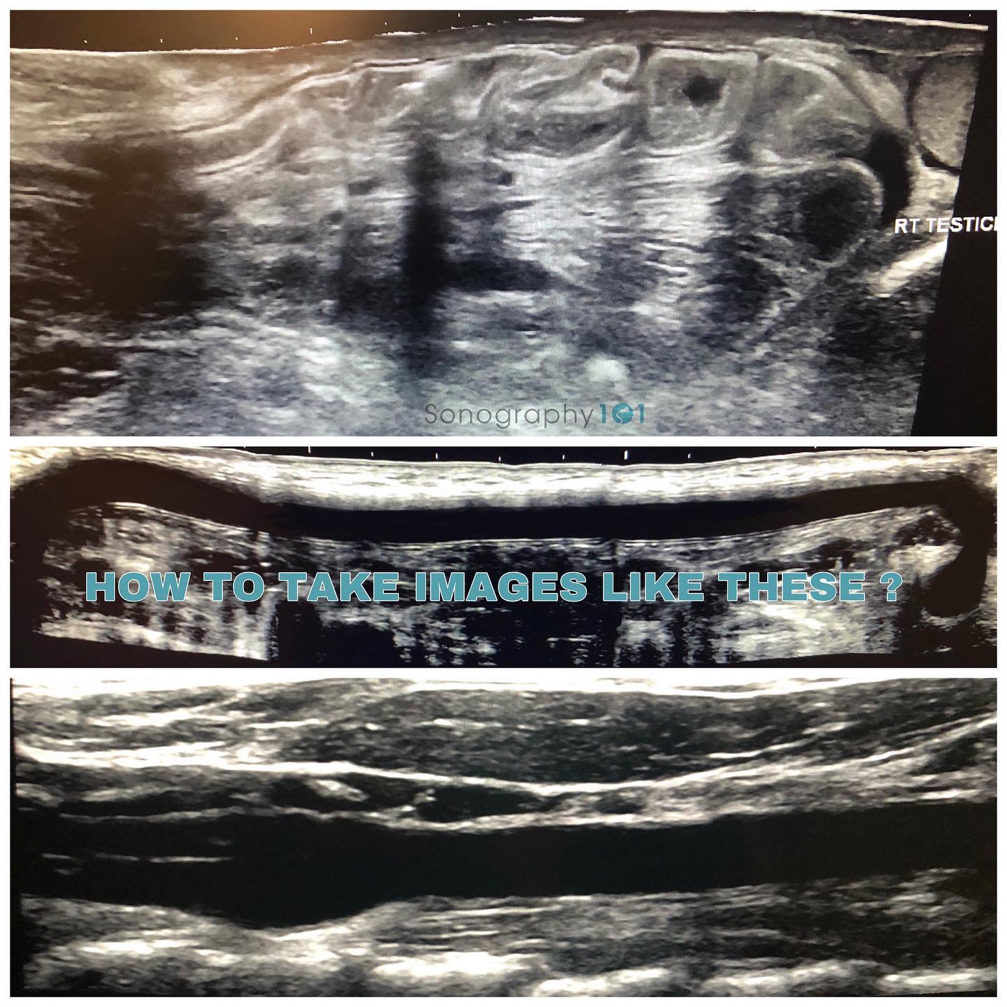 Wondeing how to take a panoramic shot 🧐 simply swipe 👉🏼 If you own a different machine and know how to use this setting, share your knowledge below with our fellow sonographers 🤗
