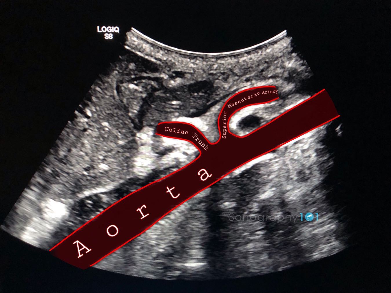 Proximal Abdominal Aorta Anatomy 😍